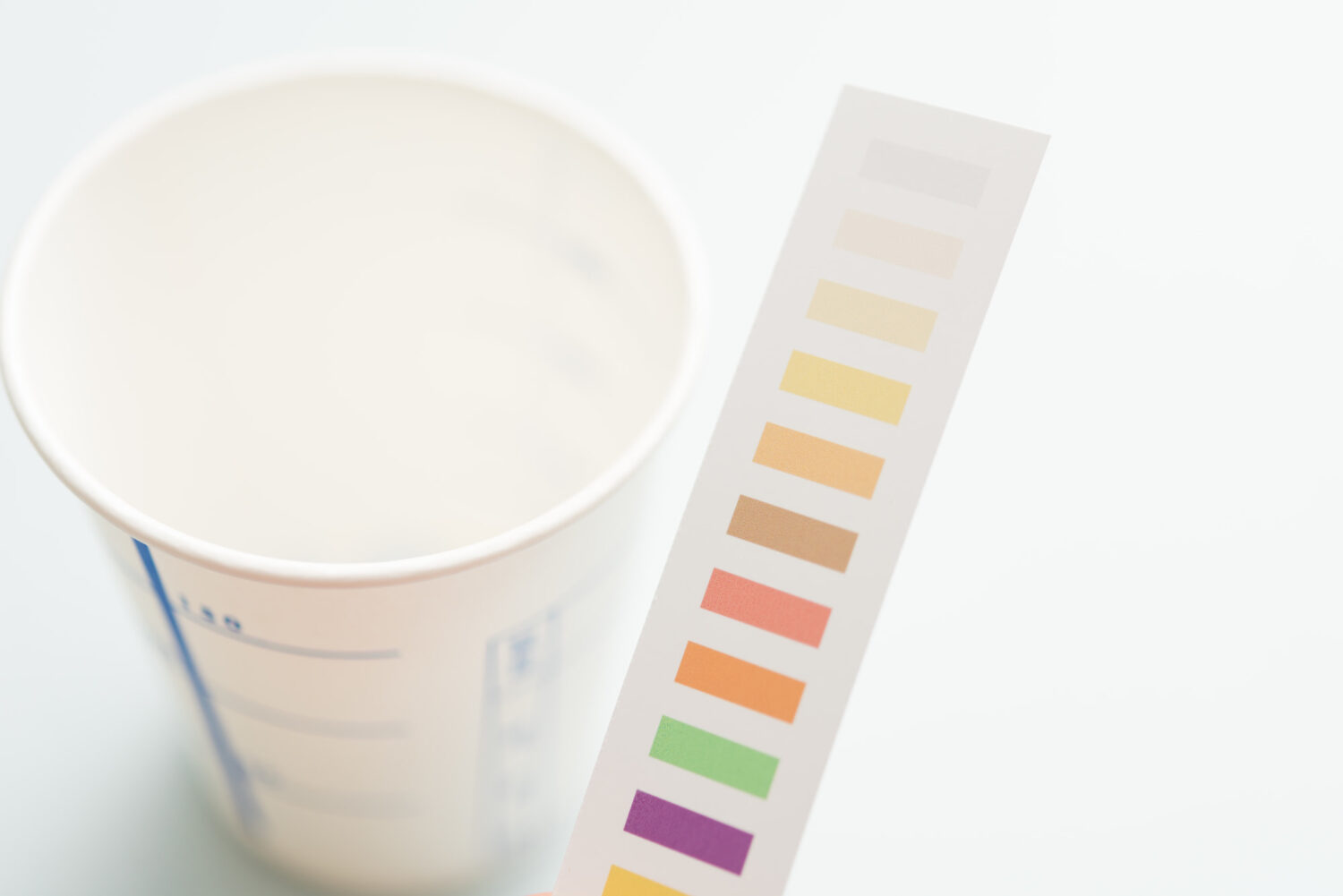 尿検査のイメージ