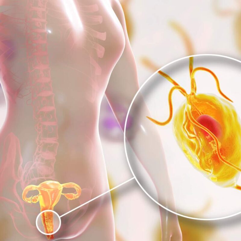 女性がトリコモナス膣炎になったイメージ