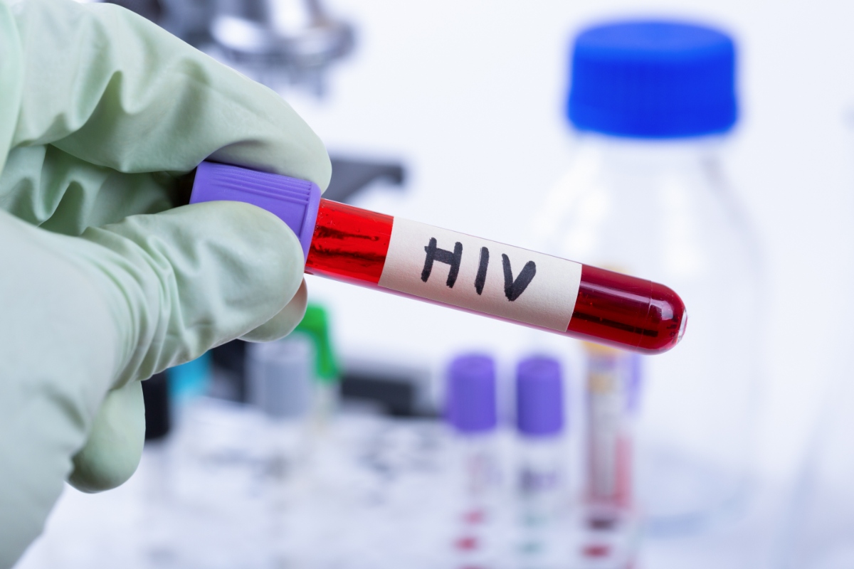 HIVのイメージ